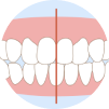 Dental Midlines Not Matched Example
