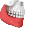 Overbite Example